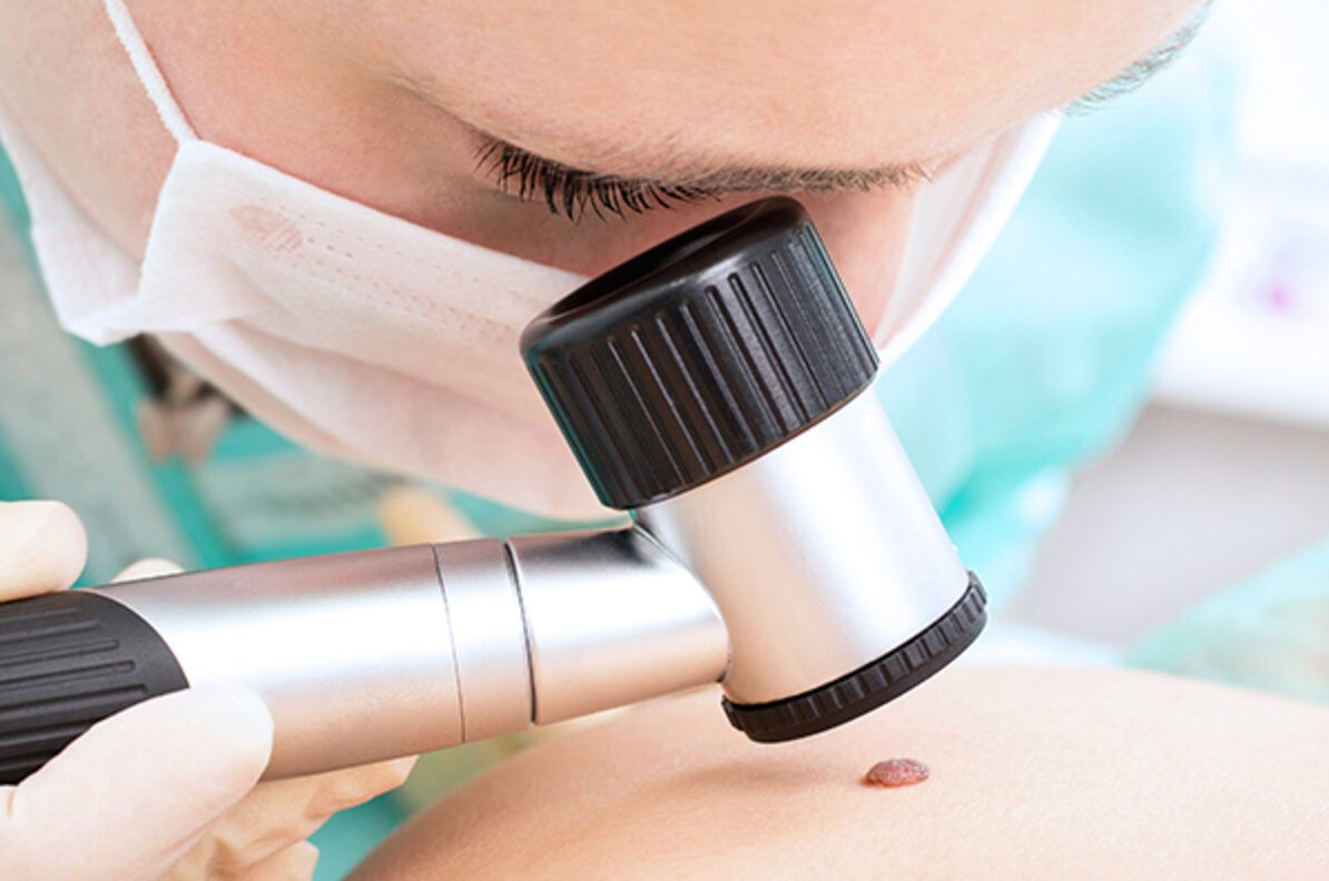 Ingyenes anyajegyszűrés az Eucerin támogatásával az EFOTT Fesztiválon