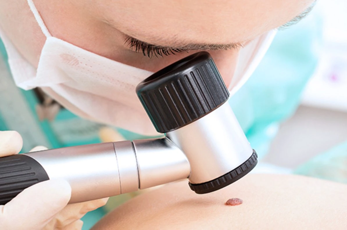 Ingyenes anyajegyszűrés az Eucerin támogatásával az EFOTT Fesztiválon