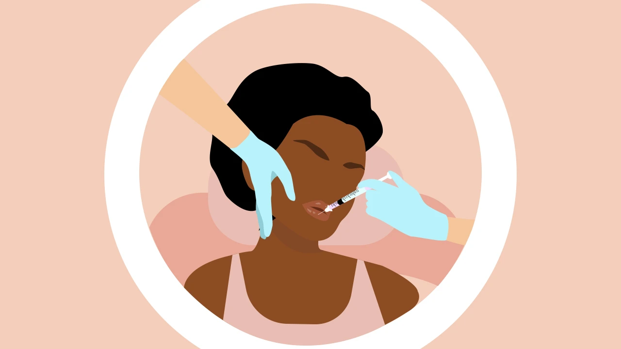 Russian lips – A legújabb szájfeltöltéstrend