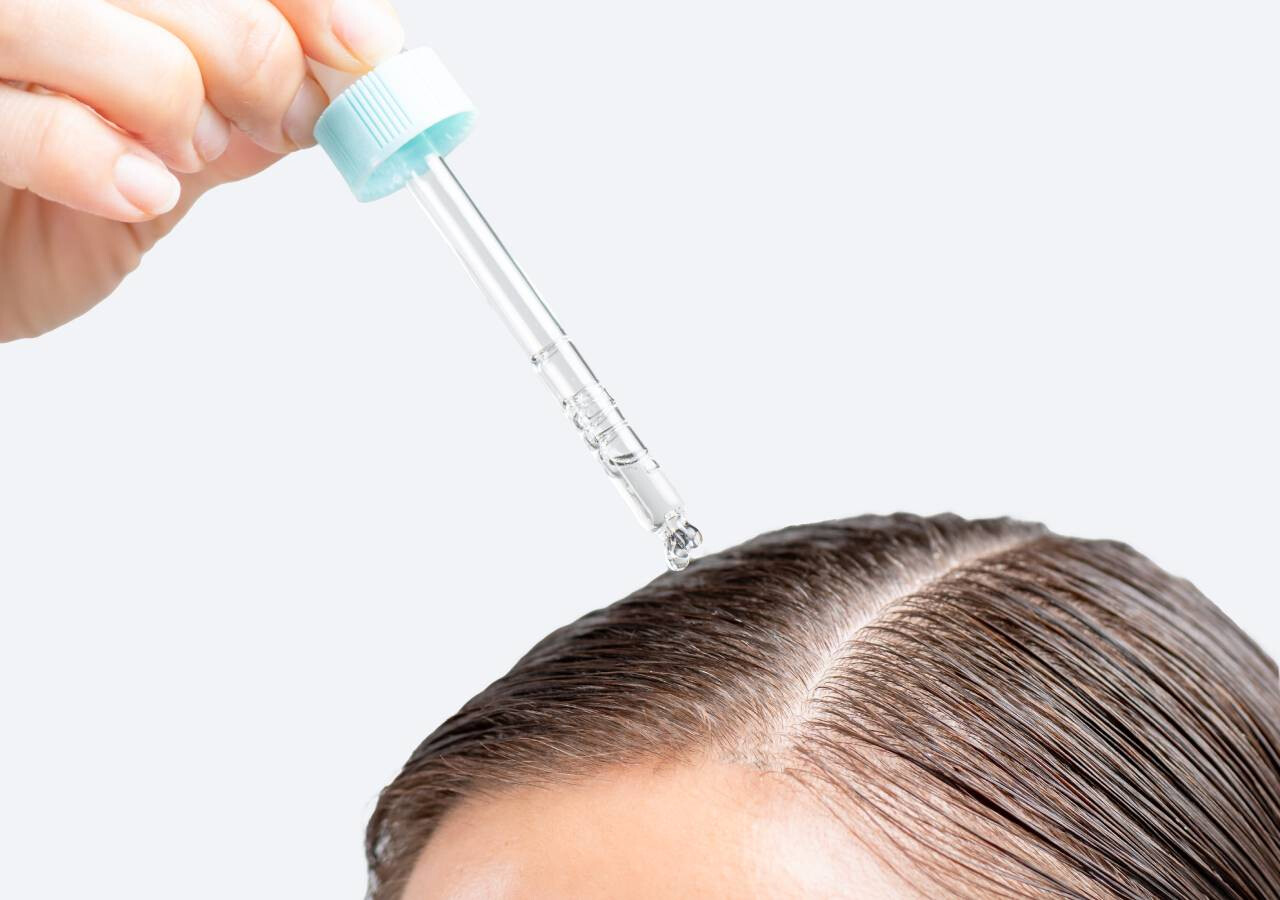 Mi az a fejbőr akné, és hogyan kezelheted hatékonyan?