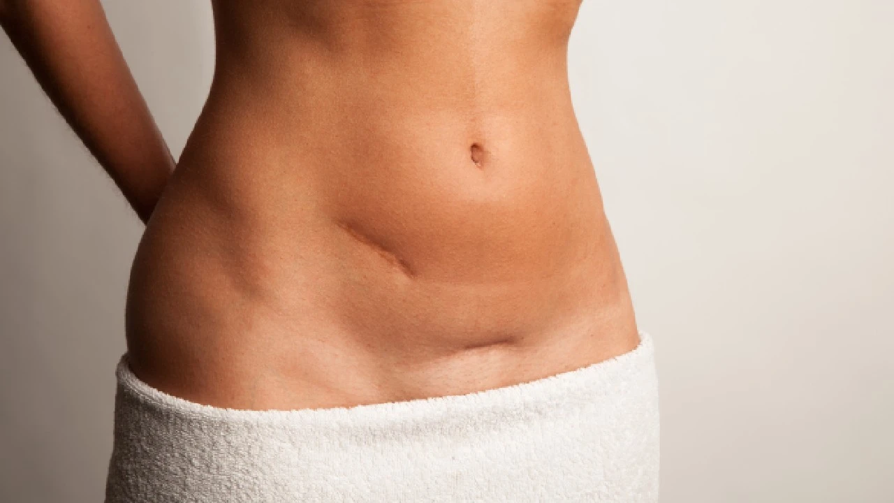 Hegek gyógyítása: Hatékony összetevők és a legjobb termékek a Krémmániáról