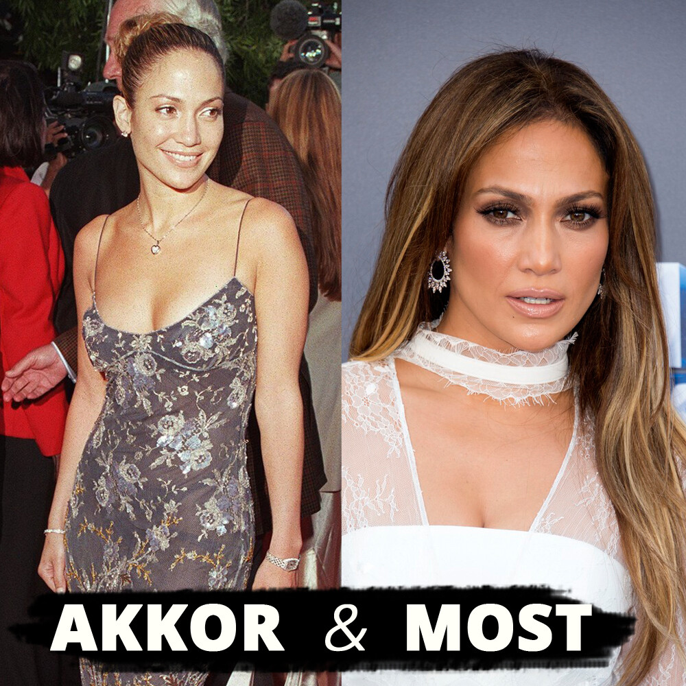 Időutazás: 10 sztár a kontúrozás elterjedése előtt és után