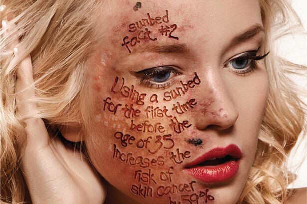 Rémisztő videó arról, mi történik a bőröddel, ha nem használsz naptejet