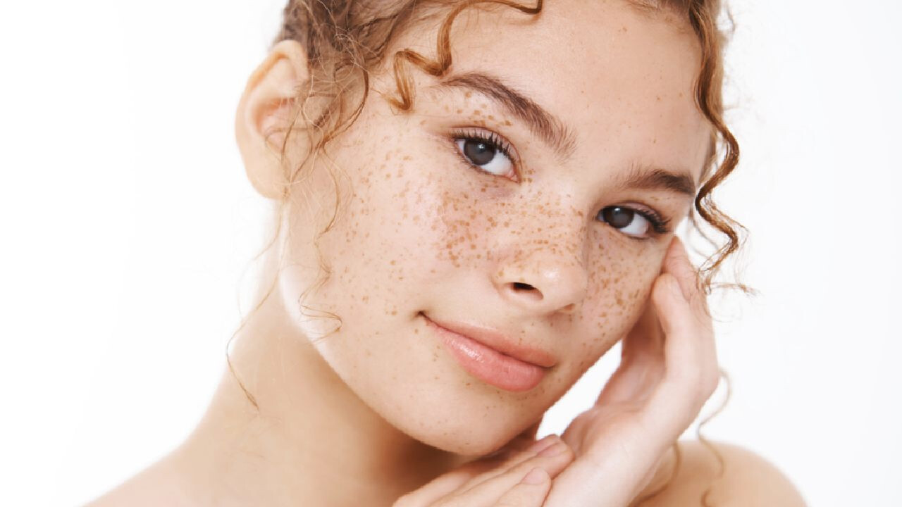 Szeplős vagy? Erre figyelj nyáron!