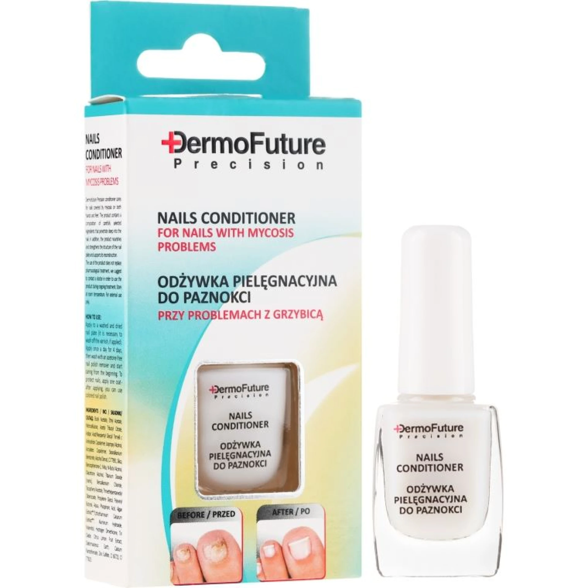 Dermofuture Course of Ttreatment Against Nail Fungus