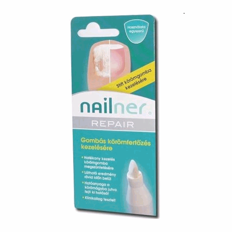 Nailner Repair Stift Velemeny